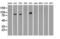 B-Raf Proto-Oncogene, Serine/Threonine Kinase antibody, LS-C784256, Lifespan Biosciences, Western Blot image 