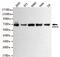 Replication Protein A1 antibody, GTX49157, GeneTex, Western Blot image 