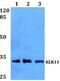 Kallikrein Related Peptidase 11 antibody, A06052, Boster Biological Technology, Western Blot image 