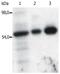 FYN Proto-Oncogene, Src Family Tyrosine Kinase antibody, M00684-1, Boster Biological Technology, Western Blot image 