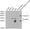 Apolipoprotein D antibody, GTX30058, GeneTex, Western Blot image 