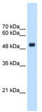 TRNA Methyltransferase 2 Homolog B antibody, TA346838, Origene, Western Blot image 