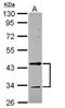 Tropomodulin 2 antibody, NBP2-20730, Novus Biologicals, Western Blot image 