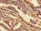 Acid Phosphatase 6, Lysophosphatidic antibody, CSB-PA889072LA01HU, Cusabio, Immunohistochemistry paraffin image 