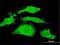 Radixin antibody, H00005962-M01, Novus Biologicals, Immunofluorescence image 