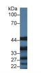 Interleukin 13 Receptor Subunit Alpha 1 antibody, LS-C294832, Lifespan Biosciences, Western Blot image 