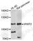 WW Domain Containing E3 Ubiquitin Protein Ligase 2 antibody, A6789, ABclonal Technology, Western Blot image 