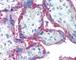 CD59 Molecule (CD59 Blood Group) antibody, 49-206, ProSci, Immunohistochemistry frozen image 