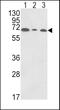 Polymeric Immunoglobulin Receptor antibody, OAAB05147, Aviva Systems Biology, Western Blot image 