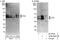 FAS antibody, A302-858A, Bethyl Labs, Western Blot image 