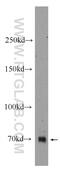 Zinc Finger Protein 658 antibody, 24823-1-AP, Proteintech Group, Western Blot image 