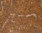 IKAROS Family Zinc Finger 3 antibody, MBS2516410, MyBioSource, Immunohistochemistry paraffin image 