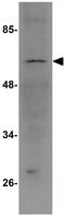 TBK1 Binding Protein 1 antibody, GTX85248, GeneTex, Western Blot image 