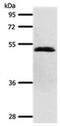 Secretin Receptor antibody, PA5-49734, Invitrogen Antibodies, Western Blot image 