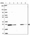 RAB6A, Member RAS Oncogene Family antibody, PA5-63663, Invitrogen Antibodies, Western Blot image 