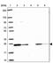 RAB6A, Member RAS Oncogene Family antibody, PA5-63663, Invitrogen Antibodies, Western Blot image 