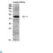 Lysosomal Associated Membrane Protein 3 antibody, LS-C813832, Lifespan Biosciences, Western Blot image 