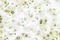 DNA Topoisomerase II Alpha antibody, LS-C177340, Lifespan Biosciences, Immunohistochemistry frozen image 