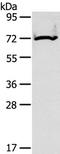 Carnitine Palmitoyltransferase 2 antibody, TA323742, Origene, Western Blot image 
