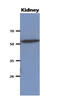 Carnosine Dipeptidase 2 antibody, LS-B8974, Lifespan Biosciences, Western Blot image 