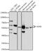 Asparagine Synthetase (Glutamine-Hydrolyzing) antibody, 16-388, ProSci, Western Blot image 