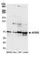 Acyl-CoA Synthetase Short Chain Family Member 2 antibody, A305-293A, Bethyl Labs, Western Blot image 