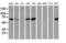 Epsin 2 antibody, LS-C173747, Lifespan Biosciences, Western Blot image 