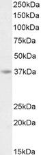 Interferon-inducible protein AIM2 antibody, 42-531, ProSci, Enzyme Linked Immunosorbent Assay image 