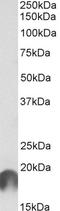 Anaphase-promoting complex subunit 11 antibody, STJ72106, St John