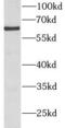 Bone Morphogenetic Protein Receptor Type 1A antibody, FNab00922, FineTest, Western Blot image 