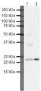 Suppressor Of Cytokine Signaling 2 antibody, PA5-19813, Invitrogen Antibodies, Western Blot image 