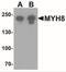Myosin Heavy Chain 8 antibody, NBP2-41309, Novus Biologicals, Western Blot image 