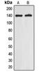 Eukaryotic Translation Initiation Factor 5B antibody, GTX55185, GeneTex, Western Blot image 