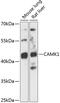 Calcium/calmodulin-dependent protein kinase type 1 antibody, 15-570, ProSci, Western Blot image 