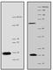 POP7 Homolog, Ribonuclease P/MRP Subunit antibody, AM32014PU-N, Origene, Western Blot image 