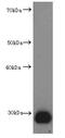 Calbindin 2 antibody, abx111297, Abbexa, Enzyme Linked Immunosorbent Assay image 