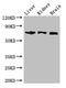 Transcription Factor 4 antibody, CSB-PA023302HA01HU, Cusabio, Western Blot image 