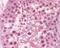 Dicer 1, Ribonuclease III antibody, PA1-41654, Invitrogen Antibodies, Immunohistochemistry paraffin image 