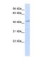 Interleukin 11 Receptor Subunit Alpha antibody, NBP1-69375, Novus Biologicals, Western Blot image 