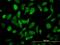 Nuclear receptor coactivator 4 antibody, H00008031-M05, Novus Biologicals, Immunofluorescence image 