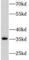 Tumor necrosis factor ligand superfamily member 10 antibody, FNab08923, FineTest, Western Blot image 