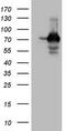 SSX Family Member 2 Interacting Protein antibody, M05918, Boster Biological Technology, Western Blot image 