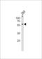 Zinc Finger Protein 76 antibody, 60-997, ProSci, Western Blot image 