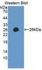 CD85d antibody, LS-C723153, Lifespan Biosciences, Western Blot image 