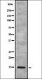 Serum Amyloid A4, Constitutive antibody, orb336908, Biorbyt, Western Blot image 