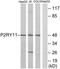 Purinergic Receptor P2Y11 antibody, TA314315, Origene, Western Blot image 