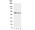 Caspase 10 antibody, R30586, NSJ Bioreagents, Western Blot image 