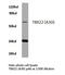 T-Box 22 antibody, AP06764PU-N, Origene, Western Blot image 