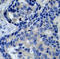 Protein Tyrosine Kinase 2 Beta antibody, LS-C335877, Lifespan Biosciences, Immunohistochemistry paraffin image 