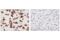 S100 Calcium Binding Protein A9 antibody, 34425S, Cell Signaling Technology, Immunohistochemistry paraffin image 